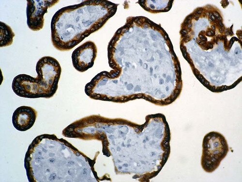 IHC of hCG on an FFPE Placenta Tissue